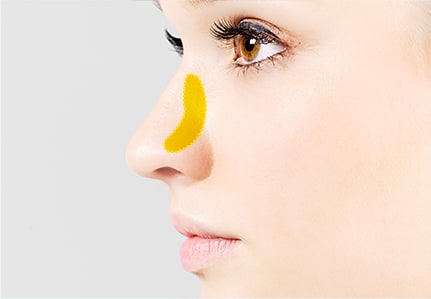 鼻中隔软骨主要用于延长鼻子的长度或在鼻尖上增加立体投影效果